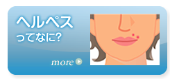 ヘルペスとは